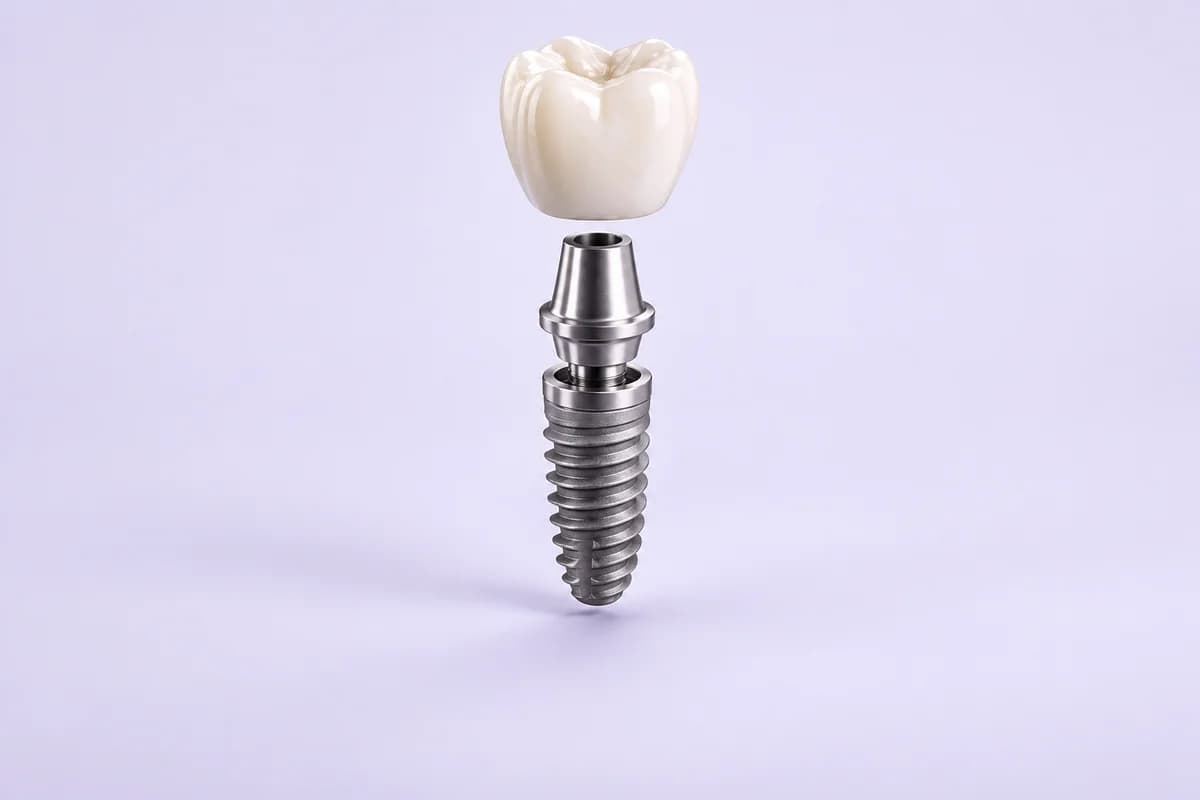 Implante dentare